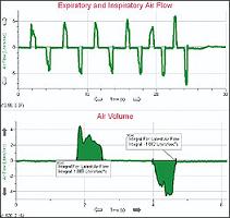 SPIROMETER