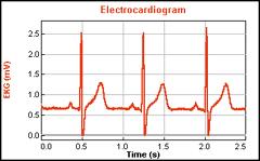 EKG SENSOR