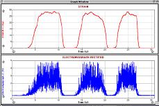 EMG SENSOR
