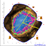 The PiCUS Sonic Tomograph