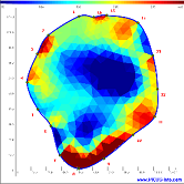 PiCUS Treetronic